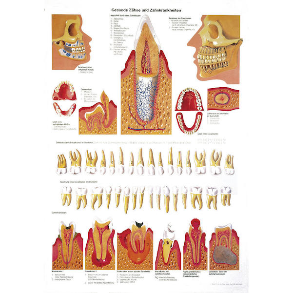 Lehrtafel Gesunde Zähne und Zahnkrankheiten