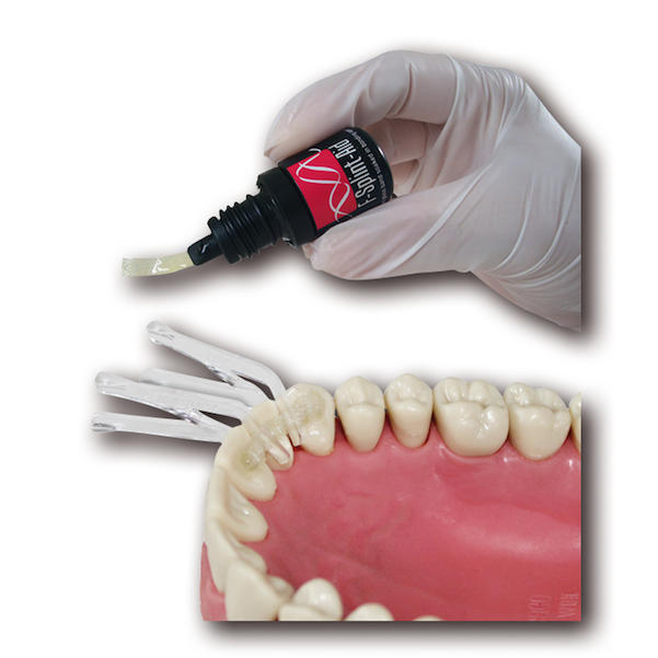 F-Splint-Aid