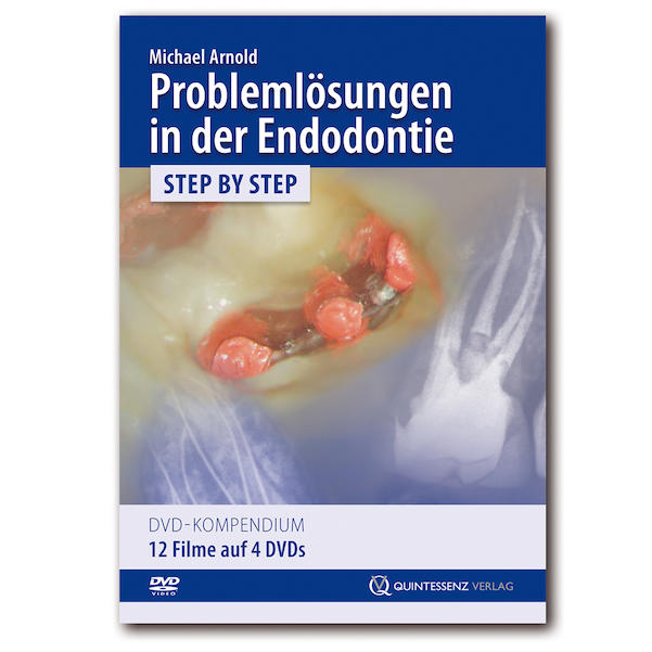 Problemlösungen in der Endodontie