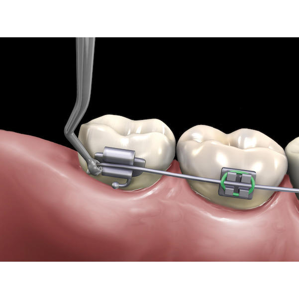 Ultra Slim Handinstrument zum distalen Umbiegen